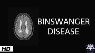 Binswanger disease Causes  Signs and Symptoms Diagnosis and Treatment [upl. by Ludwigg942]