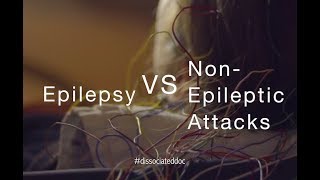 Epilepsy VS NonEpileptic Attacks Misdiagnosis amp Key Differences [upl. by Bartram907]