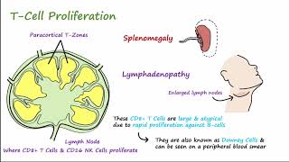 Mono  Pathophysiology Symptoms Diagnosis amp Treatment [upl. by Licht]