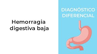 Diagnóstico Diferencial Hemorragia digestiva baja [upl. by Nwahsirhc]