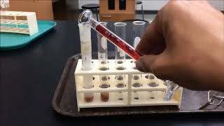 Liver and Catalase makeup lab video [upl. by Nicolea]