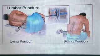 Drt 2nd year Encephalography lec 2 [upl. by Akerdal]