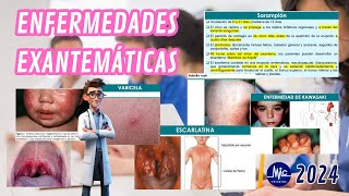 RM 24  Infectología Pediátrica Enfermedades Exantemáticas Estudios M Y C [upl. by Eriam221]