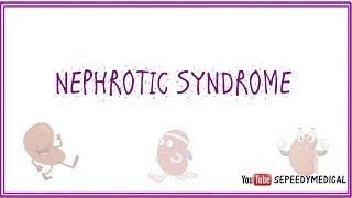 Nephrotic Syndrome Made Easy [upl. by Yenial]