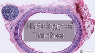 Histology of Trachea [upl. by Tucky903]