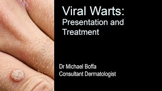 Viral Warts Presentation and Treatment [upl. by Nothsa926]