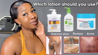 THE BEST BODY LOTIONS FOR UNEVEN SKIN  BODY ACNE  BUMPY SKIN  Fast working lotions‼️ [upl. by Pitt]