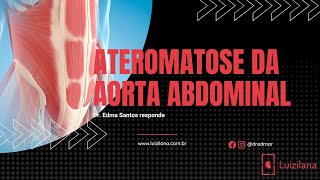 Ateromatose da aorta abdominal [upl. by Gollin]