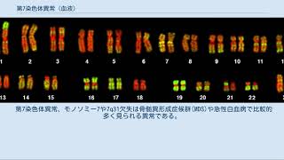 第7染色体異常 血液 [upl. by Perle104]
