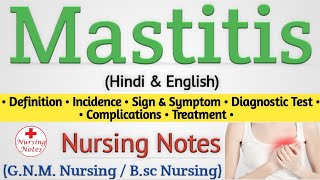 Mastitis  Mastitis In Hindi Nursing Lecture [upl. by Atir]