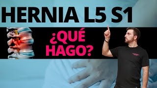 HERNIA DISCAL LUMBAR L5 S1 😯 La SOLUCIÓN DEFINITIVA ✅ [upl. by Enamrahs]