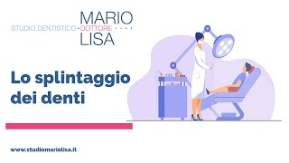 STUDIO MARIO LISA  Lo Splintaggio [upl. by Inanuah]