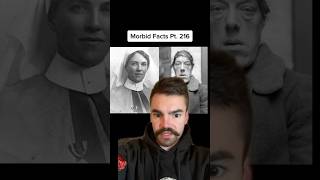 The AWFUL “Freak Show” Case of Mary Ann Bevin morbidfacts [upl. by Ahseeyt459]