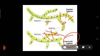 Septate hyphaeCoenocytic hyphaeneetbiologylifesxienceneet [upl. by Coffee108]