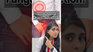 Fungal infection on skin  Ointment for fungal infection  Fungal infection in private parts [upl. by Wrigley223]