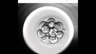 Embryoscope 2  Nuevo método de cultivo y selección embrionaria [upl. by Trenna]