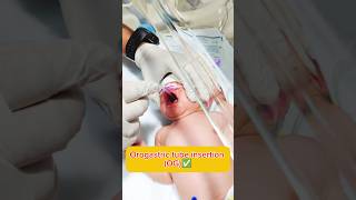 Orogastric tube insertion Nursing process hospital nursing medical trending ytshorts youtube [upl. by Conlan991]