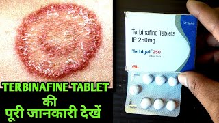 Terbinafine tablet uses and side effects in hindi [upl. by Osnofledi]