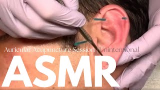 ASMR Auricular Ear Acupuncture Treatment  Real Person ASMR 💜 ft Tom [upl. by Durwin369]