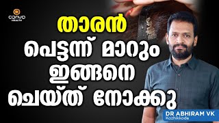 താരൻ പെട്ടന്ന് മാറാൻ വീട്ടിൽ നിന്നും ഇങ്ങനെ ചെയ്തു നോക്കു  Tharan Pokan Malayalam Tips [upl. by Lekram]