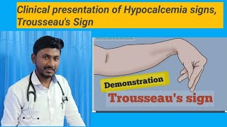 Hypocalcemia Trousseaus Sign [upl. by Betteanne694]