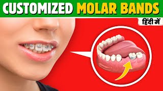 How to Make Custom Fit Ortho Molar Bands orthodontics [upl. by Luapnoj]