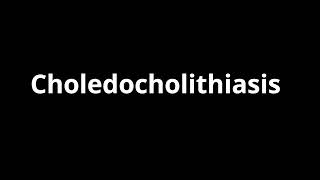 Choledocholithiasis [upl. by Arised]