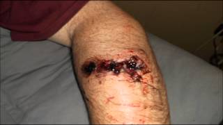 Negligent Discharge  Could it Happen to You Dougs Personal Testimony [upl. by Piks277]