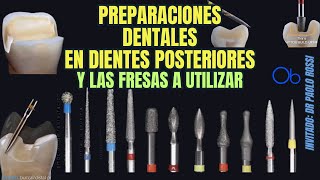 Preparaciones dentales en dientes posteriores y las fresas a utilizar 🦷 paso a paso [upl. by Dietsche]