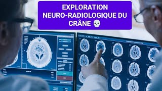 RADIOLOGIE☢️ INITIATION DE LEXPLORATION NEURORADIOLOGIQUE DU CRÂNE 3ÈME MÉDECINE✅✅Unité2🧠🦴🩺 [upl. by Nov351]