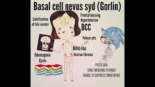 Gorlin syndrome dermatology mnemonics medical made easyskin lesionsplab usmle fcps genetics [upl. by Sublett]