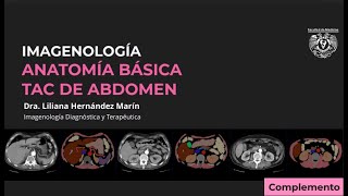 TAC DE ABDOMEN  ANATOMÍA RADIOLÓGICA BÁSICA [upl. by Yrnehnhoj]