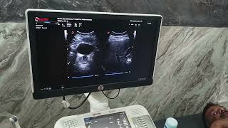 esaote MylabX5 ultrasound instalation and traning [upl. by Ihcelek]