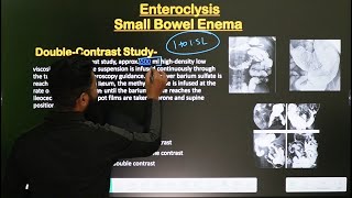 Small Bowel Enema  Enteroclysis Procedure  Part2  In Hindi  Radiological Procedure [upl. by Strickman269]