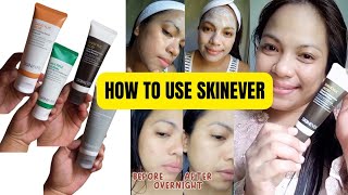 HOW TO USE SKINEVER SALICYLIC ACID [upl. by Cissiee55]