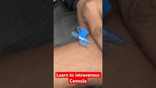 Learn to intravenous cannula  कैनुला लगाना सीखे सीखे shorts new trending SMpharmacy [upl. by Cook]