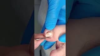 Trimming nails November 17 video 2 [upl. by Anitserp]