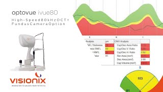 Optovue iVue80  EN [upl. by Allbee]