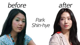 Park Shinhye before and after [upl. by Carce]