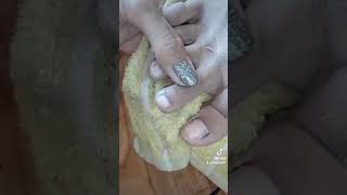 Super long nails haven’t been cut in half a year Pull out thick onychomycosis តោះមើលលេង nail​​​ [upl. by Norej]