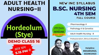 Hordeolum Stye in hindi  MSNII  BSc Nursing 4th Sem  Adult Health Nursing [upl. by Cunningham597]