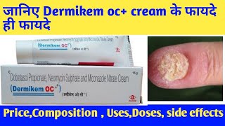 dermikem oc dermikem occlobetasol propionate neomycin sulphate and miconazole nitrate cream uses [upl. by Knipe]