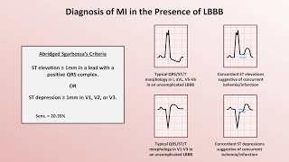 Intro to EKG Interpretation  Myocardial Infarctions Part 2 of 2 [upl. by Dagley807]