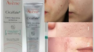 avène cicalfate أفضل كريم مرمم كيعالج تهيج البشرة والحروق السطحية والحبوب واثارها وليساكتريس [upl. by Agostino768]