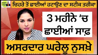 ਚਿਹਰੇ ਤੋਂ ਛਾਈਆਂ ਹਟਾਉਣ ਦਾ ਘਰੇਲੂ ਨੁਸਖ਼ਾ  Treat Pigmentation Melasma At Home  Health Advice [upl. by Ariella]