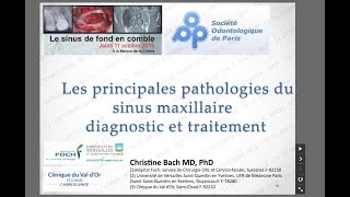 EXTRAIT « Les principales pathologies du sinus maxillaire  diagnostic et traitement » [upl. by Lorrimor573]