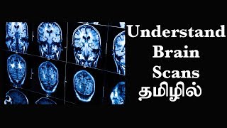 தொழில்நுட்ப்பத்தின் மூலம் மூளையைப்புரிந்துகொள்ளும் முறை Ep8 Basic Psychology in Tamil [upl. by Arraes461]