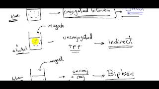 JAUNDICE  DR SAMEH GHAZY [upl. by Bollen]