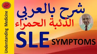 Systemic lupus erythematosus  SLE SYMPTOMS شرح بالعربي الذئبة الحمراء الأعراض [upl. by Yrtua]