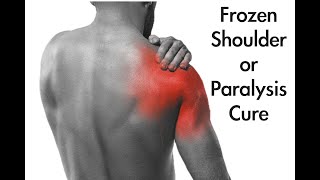 44 Frozen Shoulder or Paralysis Cure [upl. by Hiamerej]